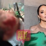 Ain Edruce Tegaskan Ajarkan Anak Jauhi Anjing Liar Usai Kasus