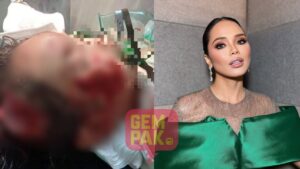 jauhi anjing liar - ilustrasi berita Ain Edruce Tegaskan Ajarkan Anak Jauhi Anjing Liar Usai Kasus